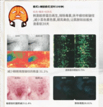 SKB-2318pro面罩美容仪(升级版) - 图片 3