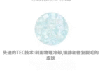 SKB-1808 男士冰点脱毛仪 - 图片 5