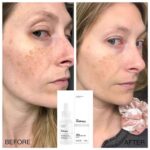 The ordinary Alpha Arbutin 熊果苷 祛斑美白液 30ml - 图片 4