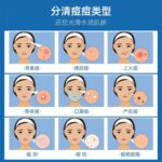 日本AKINO秋野祛痘膏 12g - 图片 5